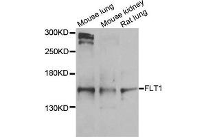 Western blot analysis of extracts of various cells, using FLT1 antibody. (FLT1 Antikörper)
