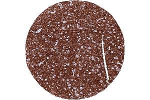 Cerebrum grey matter with intense L1CAM staining of nerve fibres (Rekombinanter L1CAM Antikörper  (AA 550-900))