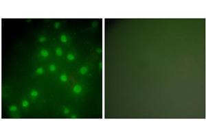 Immunofluorescence analysis of HepG2 cells, using HDAC9 antibody (ABIN5976425). (HDAC9 Antikörper  (C-Term))