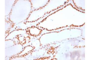 Formalin-fixed, paraffin-embedded human Thyroid stained with TTF-1 Rabbit Recombinant Monoclonal Antibody (NX2. (Rekombinanter NKX2-1 Antikörper)