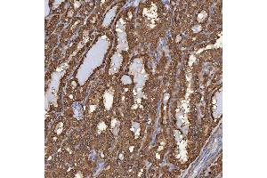 IHC analysis of SBP/SELENBP1 using anti-SBP/SELENBP1 antibody (ABIN7600755). (SELENBP1 Antikörper  (AA 23-462))