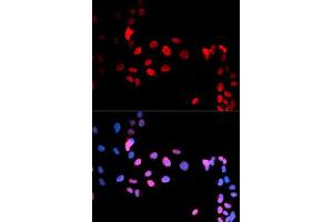 Immunofluorescent staining of U-2 OS cells with MAX (phospho S11) polyclonal antibody  at 1:50-1:200 dilution. (MAX Antikörper  (pSer11))