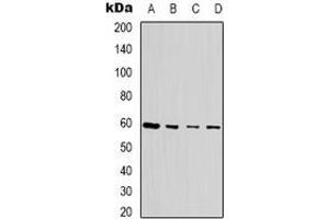 Western blot analysis of SEN54 expression in MCF7 (A), Jurkat (B), HEK293T (C), NIH3T3 (D) whole cell lysates. (TSEN54 Antikörper)