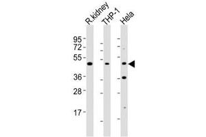 Western blot testing of BMP2 antibody at 1:2000 dilution. (BMP2 Antikörper)