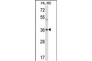 Western blot analysis in HL-60 cell line lysates (35ug/lane). (PRKACA/PRKACB Antikörper  (C-Term))