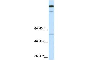 WB Suggested Anti-TIMELESS Antibody Titration:  0.