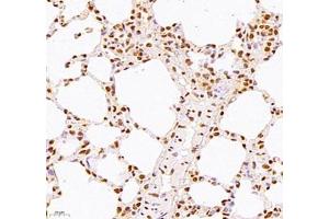 Immunohistochemistry of paraffin embedded mouse lung using WDR13 (ABIN7076212) at dilution of 1: 2500 (400x lens) (WDR13 Antikörper)