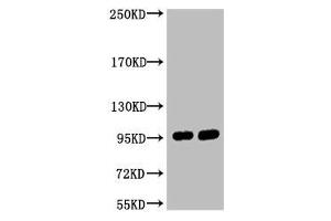 Western blot analysis of 1) Hela, 2) 293T, diluted at 1:2000. (ABCB5 Antikörper)