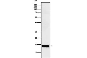 Western blot analysis of intestinal FABP expression in Human small intestine lysate.