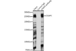 Immunoprecipitation analysis of 200 μg extracts of Jurkat cells using 3 μg CK antibody (ABIN6127628, ABIN6138647, ABIN6138648 and ABIN6224627). (CKAP5 Antikörper  (AA 1763-2032))