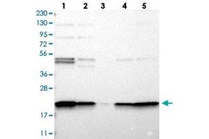Western blot analysis of Lane 1: RT-4, Lane 2: U-251 MG, Lane 3: Human Plasma, Lane 4: Liver, Lane 5: Tonsil with TMEM109 polyclonal antibody  at 1:250-1:500 dilution. (TMEM109 Antikörper)