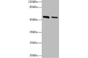 Adenylosuccinate Lyase Antikörper  (AA 1-310)