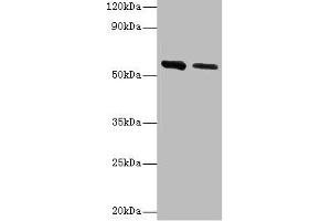 Western blot All lanes: ADSL antibody at 2 μg/mL Lane 1: Hela whole cell lysate Lane 2: Mouse heart tissue Secondary Goat polyclonal to rabbit IgG at 1/10000 dilution Predicted band size: 55, 49 kDa Observed band size: 55 kDa (Adenylosuccinate Lyase Antikörper  (AA 1-310))