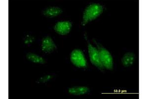 Immunofluorescence of purified MaxPab antibody to GTPBP4 on HeLa cell. (GTPBP4 Antikörper  (AA 1-634))