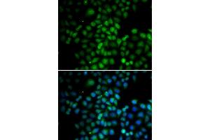 Immunofluorescence analysis of HeLa cells using C11orf30 antibody (ABIN6127845, ABIN6137722, ABIN6137724 and ABIN6217721).