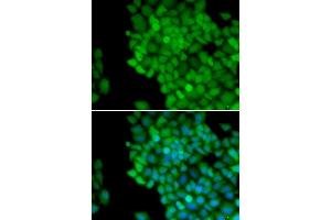 Immunofluorescence analysis of HeLa cells using MAGE-1/MA antibody (ABIN6132325, ABIN6143435, ABIN6143436 and ABIN6221133). (MAGEA1 Antikörper  (AA 1-309))