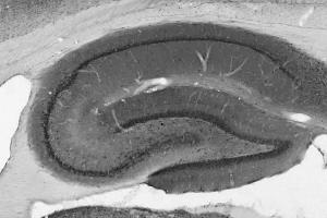 Adult rat hippocampus immunohistochemistry. (STRN4 Antikörper  (AA 42-354))