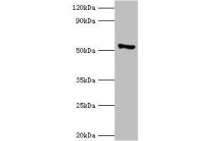 Western blot All lanes: CAMK4 antibody at 2 μg/mL + 293T whole cell lysate Secondary Goat polyclonal to rabbit IgG at 1/10000 dilution Predicted band size: 52 kDa Observed band size: 52 kDa (CAMK4 Antikörper  (AA 304-473))