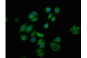 Immunofluorescence staining of HepG2 cells with ABIN7127737 at 1:100,counter-stained with DAPI. (Rekombinanter RAF1 Antikörper  (pSer259))