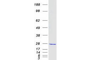 Validation with Western Blot (COMMD1 Protein (Myc-DYKDDDDK Tag))