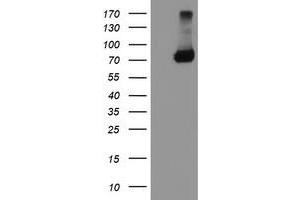 Western Blotting (WB) image for anti-TNF Receptor-Associated Protein 1 (TRAP1) antibody (ABIN1501500)