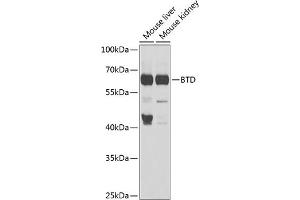 Western blot analysis of extracts of various cell lines, using BTD antibody (ABIN6127510, ABIN6137680, ABIN6137682 and ABIN6221882) at 1:1000 dilution. (BTD Antikörper  (AA 284-543))