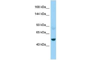 WB Suggested Anti-NEFM Antibody Titration: 1. (NEFM Antikörper  (C-Term))