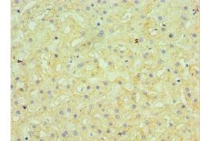 Immunohistochemistry of paraffin-embedded human liver tissue using ABIN7145506 at dilution of 1:100 (Glucuronidase beta Antikörper  (AA 382-651))
