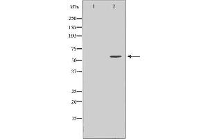 Western blot analysis of MCF7 cell lysate, using CDC25A Antibody.