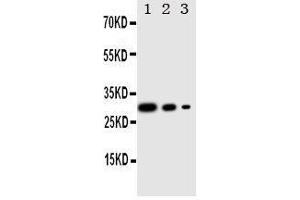 Lane 3: Recombinant Human CRTC1 Protein 2.