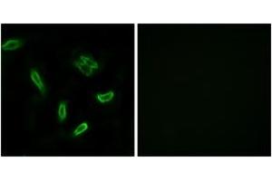 Immunofluorescence analysis of A549 cells, using SLC27A5 Antibody.