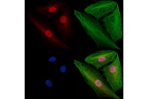 ABIN7094796 and ABIN7098847 staining  cells by IF/ICC. (SF3B1 Antikörper  (N-Term))