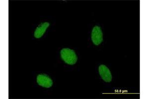 Immunofluorescence of purified MaxPab antibody to SAP30 on HeLa cell. (SAP30 Antikörper  (AA 1-220))