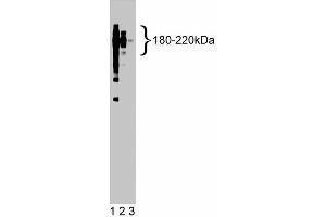 Western Blotting (WB) image for anti-Protein tyrosine Phosphatase, Receptor Type, C (PTPRC) (AA 535-730) antibody (ABIN967867)