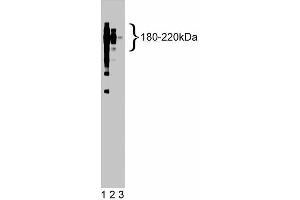 Western blot analysis of CD45 on a Jurkat cell lysate (Human T-cell leukemia, ATCC TIB-152). (CD45 Antikörper  (AA 535-730))