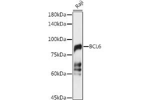 Western blot analysis of extracts of Raji cells, using BCL6 antibody (ABIN6130002, ABIN6137511, ABIN6137512 and ABIN6222987) at 1:1000 dilution. (BCL6 Antikörper  (AA 1-280))