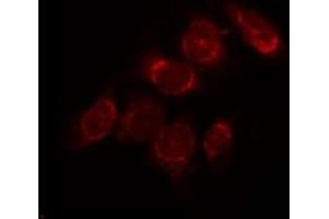 ABIN6268944 staining Hela by IF/ICC. (VDAC2 Antikörper)