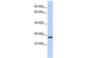 Image no. 1 for anti-Proteasome (Prosome, Macropain) Subunit, beta Type, 4 (PSMB4) (AA 107-156) antibody (ABIN6741389)
