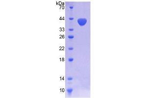 SDS-PAGE analysis of Human NOX5 Protein. (NOX5 Protein)