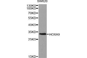 Western blot analysis of extracts of SW620 cell line, using HOXA9 antibody. (HOXA9 Antikörper  (AA 1-190))