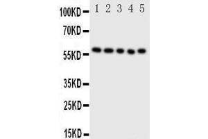 Anti-ERp57 antibody, Western blotting Lane 1: SMMC Cell Lysate Lane 2: A549 Cell Lysate Lane 3: U87 Cell Lysate Lane 4: HELA Cell Lysate Lane 5: MCF-7 Cell Lysate (PDIA3 Antikörper  (Middle Region))