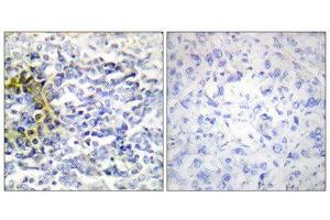 Immunohistochemistry (IHC) image for anti-Fragile X Mental Retardation, Autosomal Homolog 2 (FXR2) (C-Term) antibody (ABIN1849412) (FXR2 Antikörper  (C-Term))