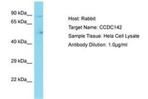 Image no. 1 for anti-Coiled-Coil Domain Containing 142 (CCDC142) (AA 658-707) antibody (ABIN6750704) (CCDC142 Antikörper  (AA 658-707))