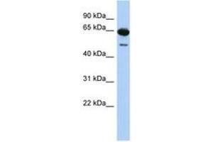 Image no. 1 for anti-Deleted in Azoospermia 1 (DAZ1) (N-Term) antibody (ABIN6744301) (DAZ1 Antikörper  (N-Term))
