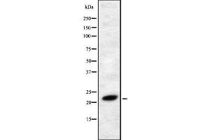 Western blot analysis FGF4 using RAW264. (FGF4 Antikörper  (Internal Region))