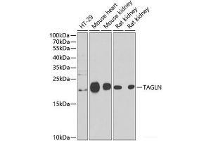 Western blot analysis of extracts of various cell lines using TAGLN Polyclonal Antibody at dilution of 1:1000. (Transgelin Antikörper)