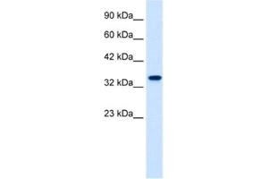 Western Blotting (WB) image for anti-Zinc Finger Protein 2 (ZNF2) antibody (ABIN2461260) (ZNF2 Antikörper)