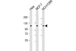 All lanes : Anti-P1R13L Antibody (Center) at 1:2000 dilution Lane 1: Hela whole cell lysates Lane 2: MCF-7 whole cell lysates Lane 3: NCI- whole cell lysates Lysates/proteins at 20 μg per lane. (PPP1R13L Antikörper  (AA 455-485))