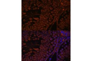 Immunofluorescence analysis of rat testis using TPD52L3 antibody (ABIN7271079) at dilution of 1:100. (TPD52L3 Antikörper  (AA 1-132))