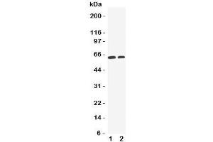 Western blot testing of OCT1 antibody and Lane 1:  HeLa;  2: A549 cell lysate. (SLC22A1 Antikörper  (C-Term))